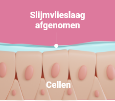 irritatie van de keel